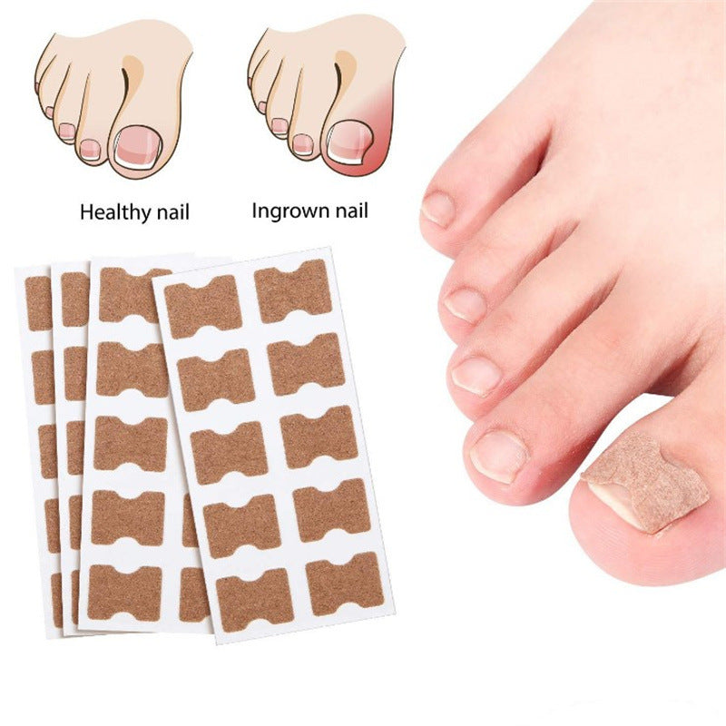 Glue-free Orthopedic Toenail Groove Inlay Corrector Onychomycosis Toe Care Corrector Inflammation Toenail Patch