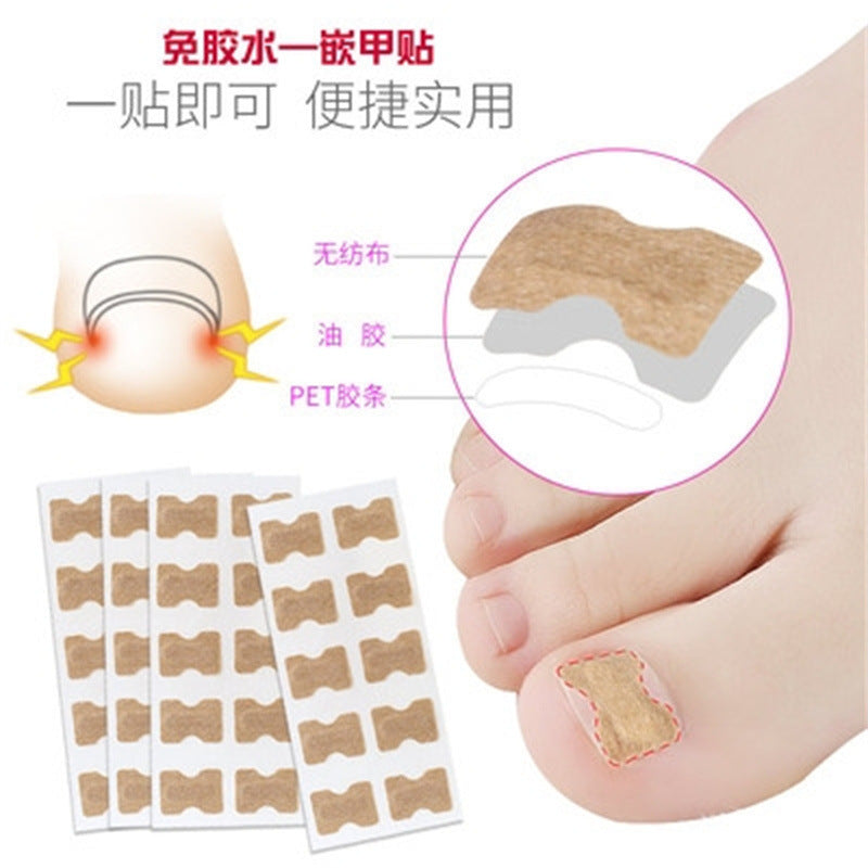 Glue-free Orthopedic Toenail Groove Inlay Corrector Onychomycosis Toe Care Corrector Inflammation Toenail Patch