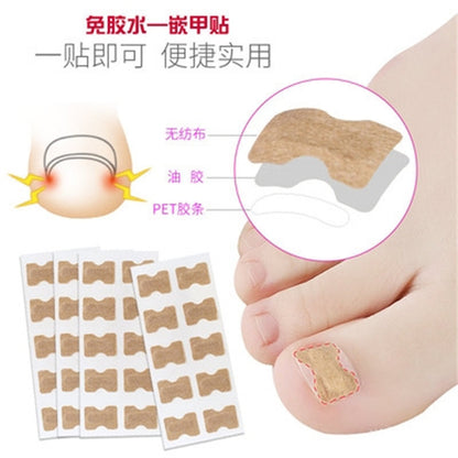 Glue-free Orthopedic Toenail Groove Inlay Corrector Onychomycosis Toe Care Corrector Inflammation Toenail Patch